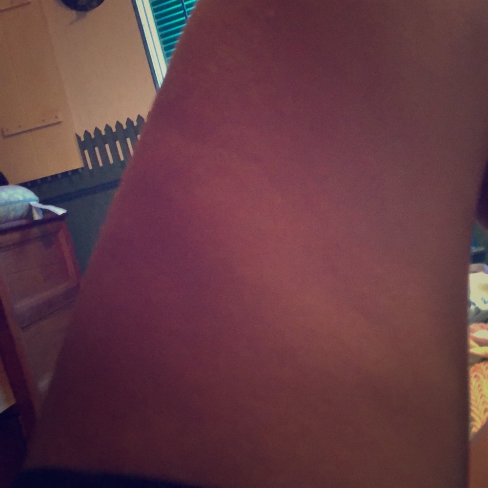 Leg